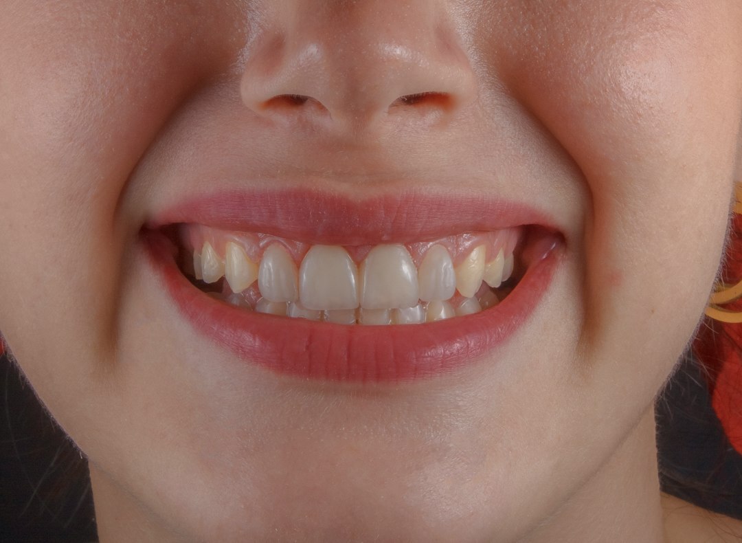 Dental assessment
